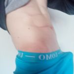 Anonimen25
