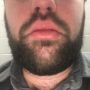 Mtlfunguy